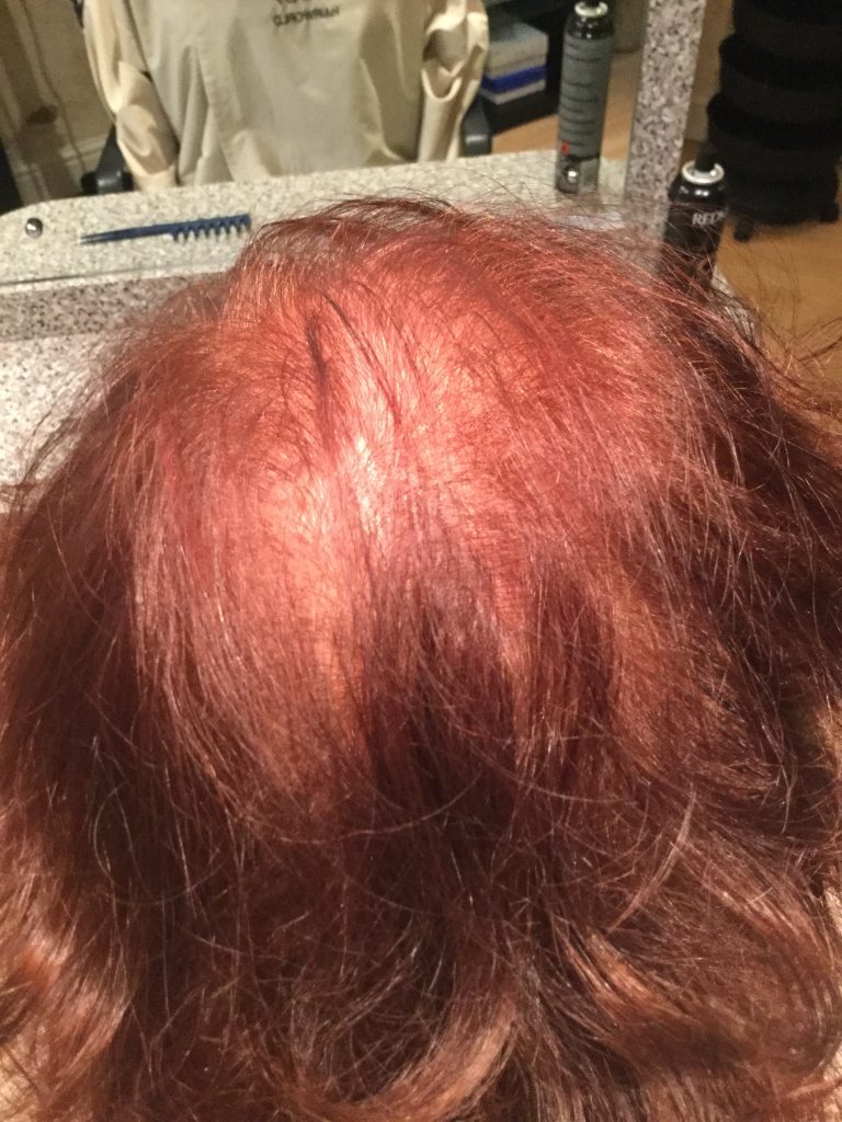 img 1390