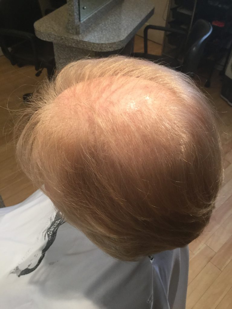 blond short before