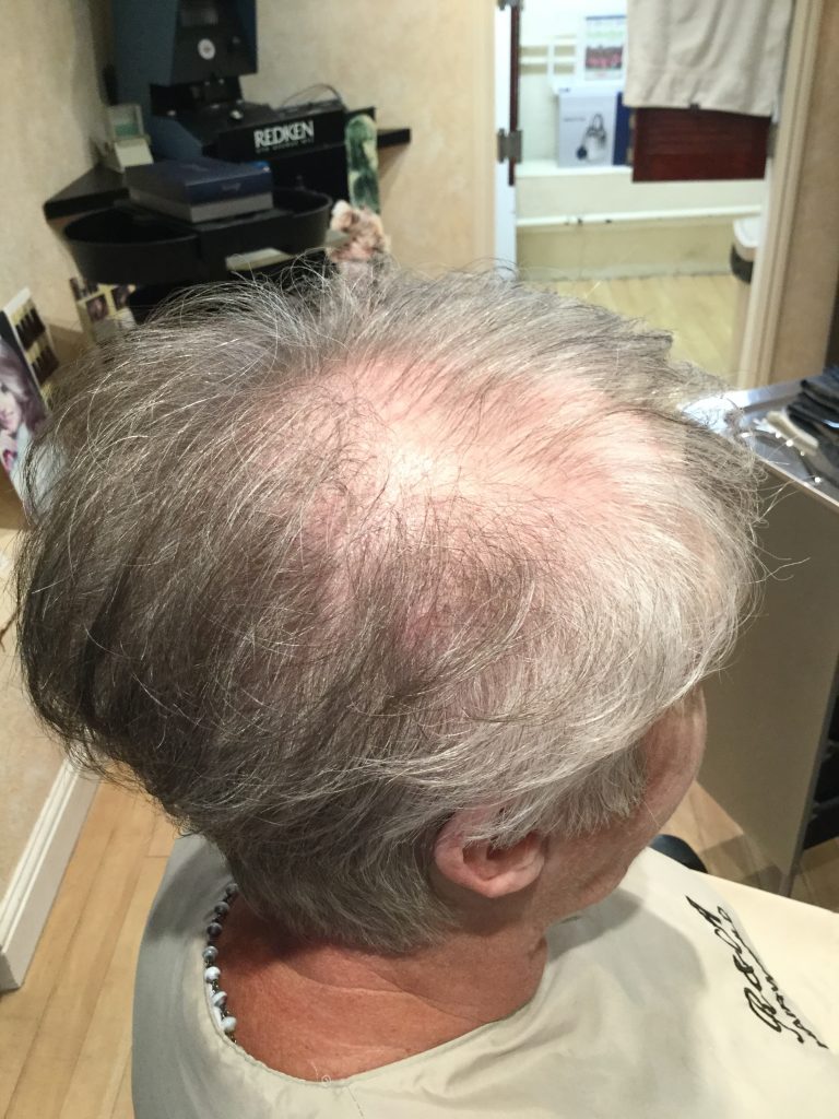 silver short before