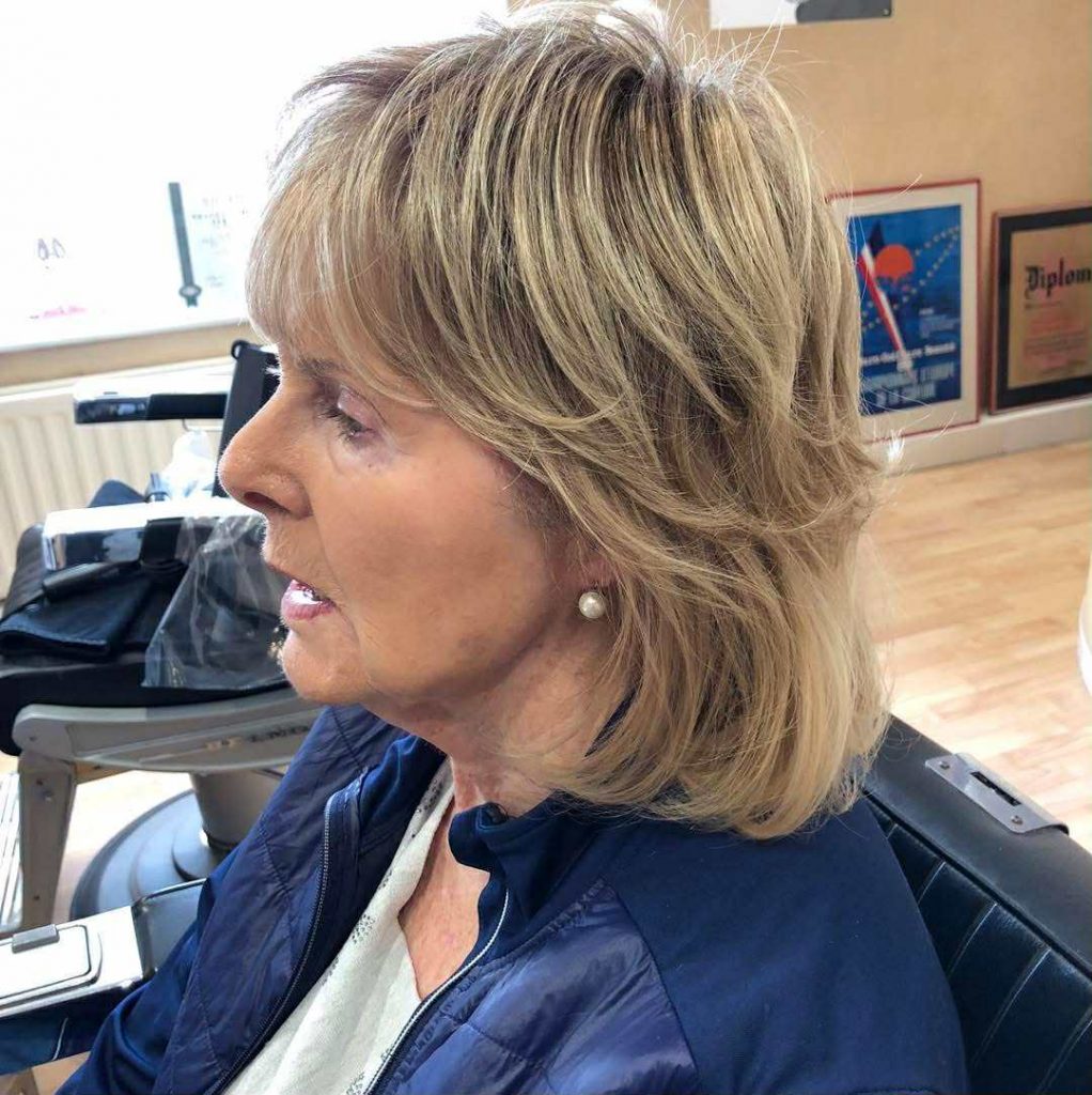 scarring from medical procedure topper scarring from medical procedure topper